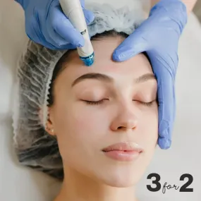 3 for 2 Microneedling Treatment Trio